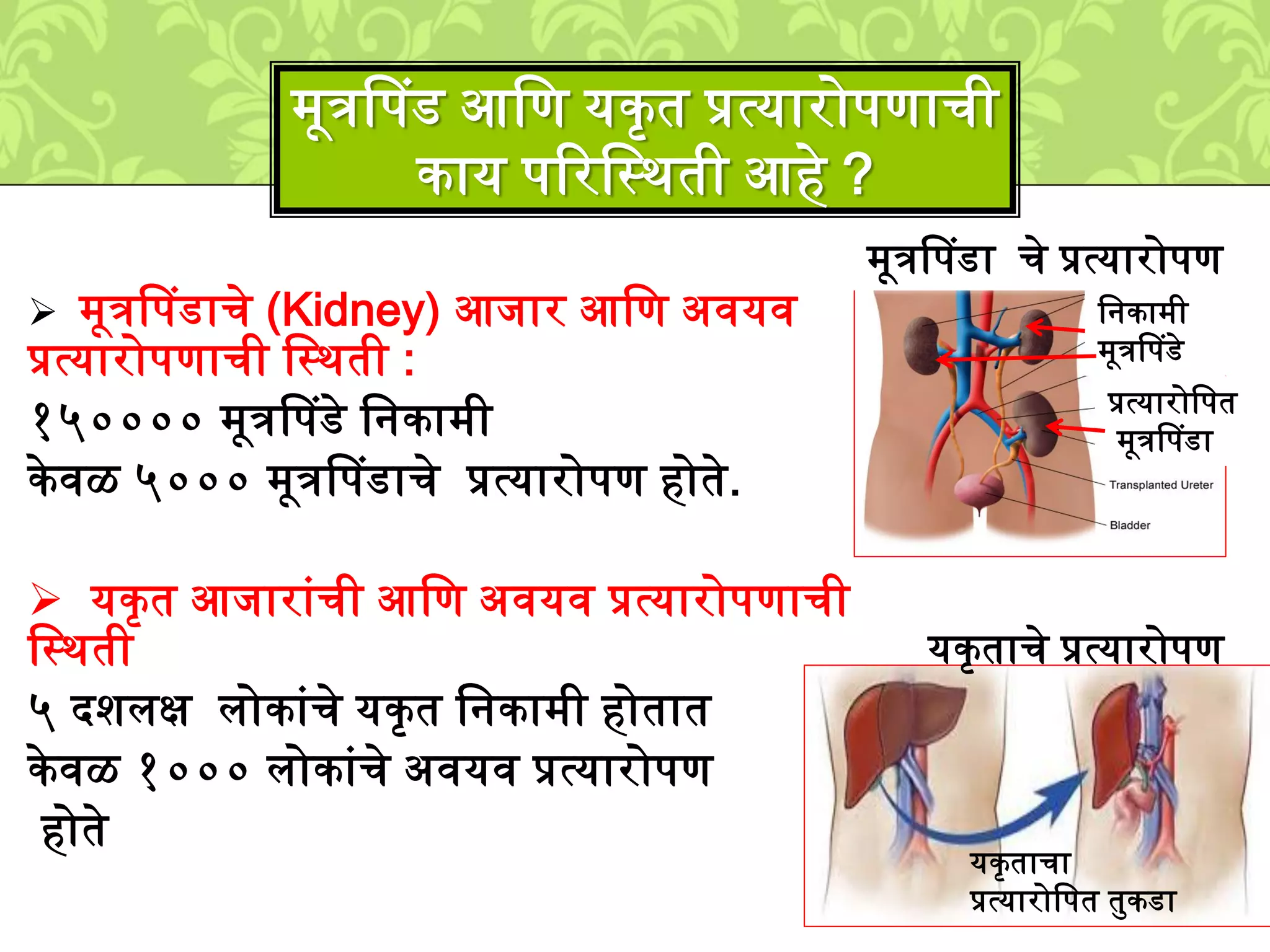  ्ूत्रपपडाचे (Kidney) आिार आलण अवयव
प्रत्यारोपणाची लस्र्ती :
१५०००० ्ूत्रपपडे लनका्ी
के वळ ५००० ्ूत्रपपडाचे प्रत्यारोपण होते.
यकृ त आिाराुंची आलण अवयव प्रत्यारोपणाची
लस्र्ती
५ दििक्ष िोकाुंचे यकृ त लनका्ी होतात
के वळ १००० िोकाुंचे अवयव प्रत्यारोपण
होते
्ूत्रपपड आलण यकृत प्रत्यारोपणाची
काय पटरलस्र्ती आहे ?
्ूत्रपपडा चे प्रत्यारोपण
प्रत्यारोलपत
्ूत्रपपडा
लनका्ी
्ूत्रपपडे
यकृताचे प्रत्यारोपण
यकृताचा
प्रत्यारोलपत तमकडा