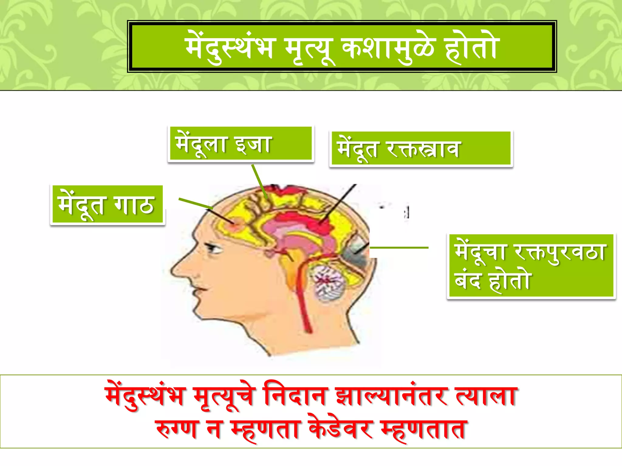 ्ेंदमस्र्ुंभ ्ृत्यूचे लनदान झाल्यानुंतर त्यािा
रुग्ण न म्हणता केडेवर म्हणतात
्ेंदमस्र्ुंभ ्ृत्यू किा्मळे होतो
्ेंदूत गाठ
्ेंदूिा इिा ्ेंदूत रक्तस्त्राव
्ेंदूचा रक्तपमरवठा
बुंद होतो