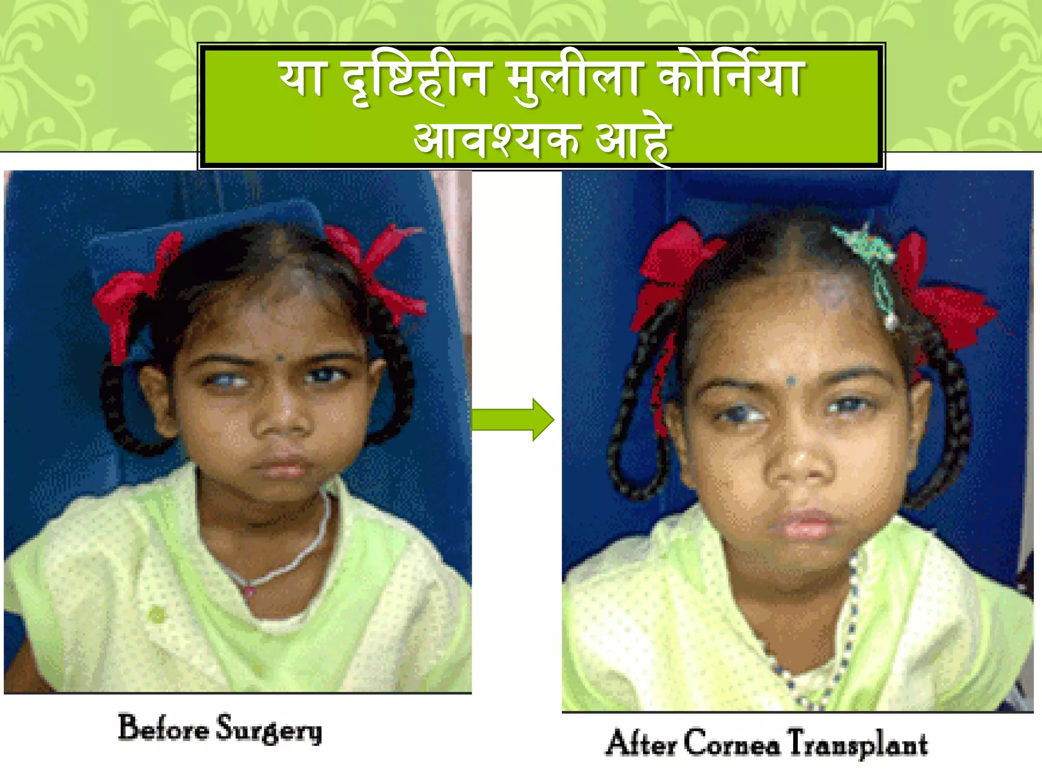 या दृलिहीन ्मिीिा कोर्षनया
आवश्यक आहे