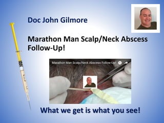 Marathon Man Scalp/Neck Abscess
Follow-Up!
What we get is what you see!
Doc John Gilmore
 