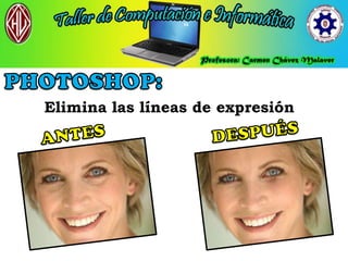 Elimina las líneas de expresión
 