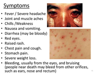 Symptoms
• Fever / Severe headache
• Joint and muscle aches
• Chills /Weakness
• Nausea and vomiting.
• Diarrhea (may be bloody)
• Red eyes.
• Raised rash.
• Chest pain and cough.
• Stomach pain.
• Severe weight loss.
• Bleeding, usually from the eyes, and bruising
(people near death may bleed from other orifices,
such as ears, nose and rectum) 11
 