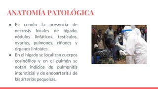 ANATOMÍA PATOLÓGICA
● Es común la presencia de
necrosis focales de hígado,
nódulos linfáticos, testículos,
ovarios, pulmones, riñones y
órganos linfoides.
● En el hígado se localizan cuerpos
eosinófilos y en el pulmón se
notan indicios de pulmonitis
intersticial y de endoarteritis de
las arterias pequeñas.
 