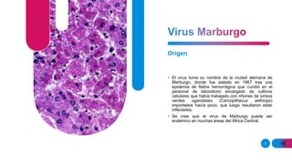 Origen
• El virus toma su nombre de la ciudad alemana de
Marburgo, donde fue aislado en 1967 tras una
epidemia de fiebre hemorrágica que cundió en el
personal de laboratorio encargado de cultivos
celulares que había trabajado con riñones de simios
verdes ugandeses (Cercopithecus aethiops)
importados hacía poco, que luego resultaron estar
infectados.
• Se cree que el virus de Marburgo puede ser
endémico en muchas áreas del África Central.
3
 