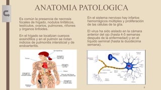 ANATOMIA PATOLOGICA
Es común la presencia de necrosis
focales de hígado, nodulos linfáticos,
testículos, ovarios, pulmones, riñones
y órganos linfoides.
En el hígado se localizan cuerpos
eosinófilos y en el pulmón se notan
indicios de pulmonitis intersticial y de
endoarteritis.
En el sistema nervioso hay infartos
hemorrágicos múltiples y proliferación
de las células de la glía.
El virus ha sido aislado en la cámara
anterior del ojo (hasta 4-5 semanas
después de la enfermedad) y en el
líquido seminal (hasta la duodécima
semana).
8
 