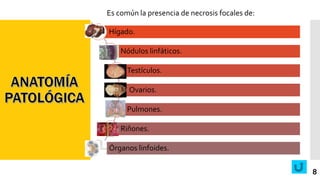 Es común la presencia de necrosis focales de:
Hígado.
Nódulos linfáticos.
Testículos.
Ovarios.
Pulmones.
Riñones.
Órganos linfoides.
8
 