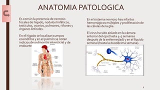 ANATOMIA PATOLOGICA
Es común la presencia de necrosis
focales de hígado, nodulos linfáticos,
testículos, ovarios, pulmones, riñones y
órganos linfoides.
En el hígado se localizan cuerpos
eosinófilos y en el pulmón se notan
indicios de pulmonitis intersticial y de
endoarteritis.
En el sistema nervioso hay infartos
hemorrágicos múltiples y proliferación de
las células de la glía.
El virus ha sido aislado en la cámara
anterior del ojo (hasta 4-5 semanas
después de la enfermedad) y en el líquido
seminal (hasta la duodécima semana).
8
 
