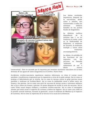 M a r c a R o j a | 45
Los daños cerebrales
isquémicos, después de
la vacunación, desde
niños a adultos, son
transversales a todos los
síntomas médicos
basados en los puntos
finales de diagnóstico.
La diabetes mellitus
dependiente de la
insulina tipo 1, es un
trastorno en masa, como
es la Enfermedad de
Parkinson, el síndrome
de Tourette, la esclerosis
múltiple y varios otros
trastornos
neuropsiquiátricos.
La afasia y la pérdida de
las funciones de voz
expresiva con las
vacunas, es llamada
"síndrome de
aislamiento de voz" o
"afasia motora
transcortical". Esto es causado por la isquemia por terminar territorios vasculares de la línea
divisoria de las aguas de vasos sanguíneos en el cerebro. Punto Final.
Accidentes cerebro-vasculares isquémicos masivos silenciosos, es cómo el cuerpo causó
parálisis e insuficiencia respiratoria por la exposición a virus de la polio salvaje. Así es como se
produjo el fallecimiento por la viruela. Así es como la vacuna contra la gripe porcina causó
parálisis y síndrome de Guillain-Barré. Así es como la talidomida causó a bebés nacer sin
brazos y sin piernas. Así es como una serie de vacunas de ántrax causa a veteranos militares
dar a luz a niños sin brazos y piernas 18 meses después de recibir la serie de vacunas. Así es
como Vioxx causó ataque cardíaco y accidente cerebro-vascular. Así es como el sarampión
alemán pre-natal causó el espectro de autismo y daños de órganos. Así es como una caída en
la presión arterial materna, durante la gestación, causa el síndrome de Moebius (y el espectro
de autismo). Así es como la repetición de la vacuna es la causa de la demencia.
 