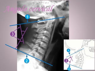Marcaciones Columna Cervical - 2A - 3.pdf