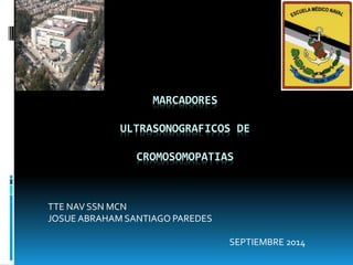 MARCADORES
ULTRASONOGRAFICOS DE
CROMOSOMOPATIAS
TTE NAV SSN MCN
JOSUE ABRAHAM SANTIAGO PAREDES
SEPTIEMBRE 2014
 