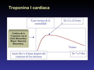 Troponina I cardiaca 