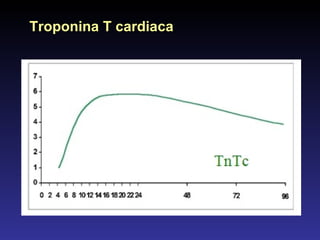 Troponina T cardiaca 