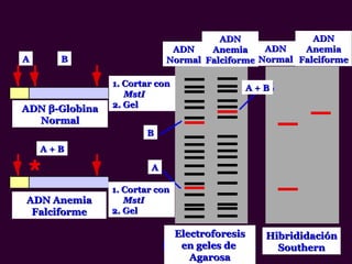 ADNADN
AnemiaAnemia
FalciformeFalciforme
ADNADN
AnemiaAnemia
FalciformeFalciforme
ADNADN
NormalNormal
ADNADN
NormalNormalAA BB
A + BA + B
A + BA + B
AA
BB
1. Cortar con1. Cortar con
MstIMstI
2. Gel2. Gel
1. Cortar con1. Cortar con
MstIMstI
2. Gel2. Gel
ADNADN ββ-Globina-Globina
NormalNormal
ADN AnemiaADN Anemia
FalciformeFalciforme
HibrididaciHibrididaciónón
SouthernSouthern
ElectroforesisElectroforesis
en geles deen geles de
AgarosaAgarosa
 