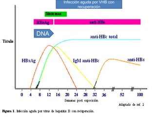 Infección aguda por VHB con
recuperación
DNA
 