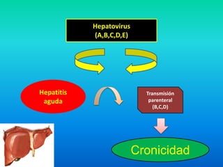 Hepatovirus
(A,B,C,D,E)
Hepatitis
aguda
Transmisión
parenteral
(B,C,D)
Cronicidad
 