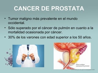 CANCER DE PROSTATA
• Tumor maligno más prevalente en el mundo
occidental.
• Sólo superado por el cáncer de pulmón en cuanto a la
mortalidad ocasionada por cáncer.
• 30% de los varones con edad superior a los 50 años.
 