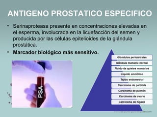 ANTIGENO PROSTATICO ESPECIFICO
• Serinaproteasa presente en concentraciones elevadas en
el esperma, involucrada en la licuefacción del semen y
producida por las células epitelioides de la glándula
prostática.
• Marcador biológico más sensitivo.
 
