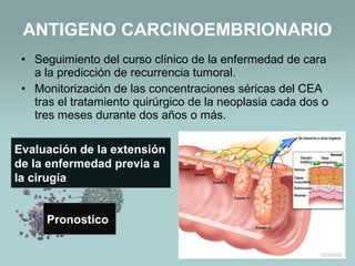 • Seguimiento del curso clínico de la enfermedad de cara
a la predicción de recurrencia tumoral.
• Monitorización de las concentraciones séricas del CEA
tras el tratamiento quirúrgico de la neoplasia cada dos o
tres meses durante dos años o más.
ANTIGENO CARCINOEMBRIONARIO
Evaluación de la extensión
de la enfermedad previa a
la cirugía
Pronostico
 