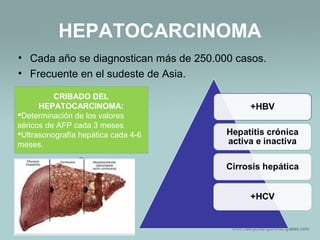 HEPATOCARCINOMA
• Cada año se diagnostican más de 250.000 casos.
• Frecuente en el sudeste de Asia.
CRIBADO DEL
HEPATOCARCINOMA:
Determinación de los valores
séricos de AFP cada 3 meses
Ultrasonografía hepática cada 4-6
meses.
 