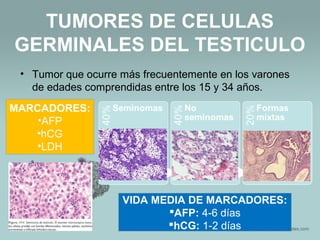 TUMORES DE CELULAS
GERMINALES DEL TESTICULO
• Tumor que ocurre más frecuentemente en los varones
de edades comprendidas entre los 15 y 34 años.
MARCADORES:
•AFP
•hCG
•LDH
VIDA MEDIA DE MARCADORES:
AFP: 4-6 días
hCG: 1-2 días
 