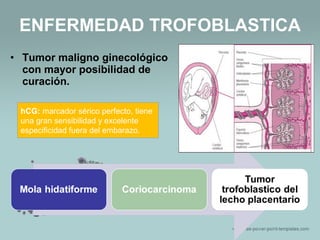ENFERMEDAD TROFOBLASTICA
• Tumor maligno ginecológico
con mayor posibilidad de
curación.
hCG: marcador sérico perfecto, tiene
una gran sensibilidad y excelente
especificidad fuera del embarazo.
 