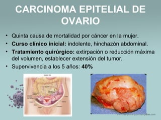 CARCINOMA EPITELIAL DE
OVARIO
• Quinta causa de mortalidad por cáncer en la mujer.
• Curso clínico inicial: indolente, hinchazón abdominal.
• Tratamiento quirúrgico: extirpación o reducción máxima
del volumen, establecer extensión del tumor.
• Supervivencia a los 5 años: 40%
 