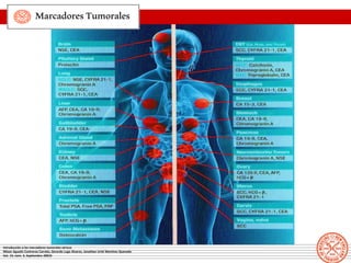 MarcadoresTumorales
Introducción a los marcadores tumorales séricos
Nilson Agustín Contreras Carreto, Gerardo Lugo Álvarez...