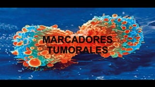 MARCADORES
TUMORALES
 