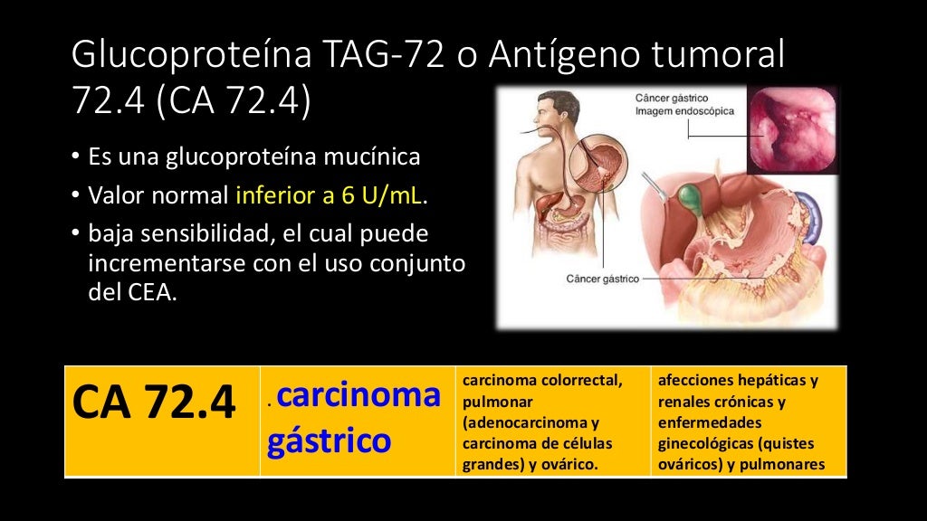 Marcadores tumorales AZR Marcadores tumorales AZR