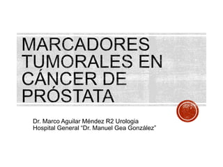 Dr. Marco Aguilar Méndez R2 Urologia
Hospital General “Dr. Manuel Gea González”
 