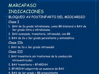 MARCAPASO INDICACIONES BLOQUEO AV POSTINFARTO DEL MIOCARDIO Clase I 1. BAV de 2o grado infrahisiano, como BR bilateral o BAV de 3er grado intra o infrahisiano. 2. BAV avanzado, transitorio, infranodal, con BR 3. BAV de 2o o 3er grado persistente y sintomático Clase IIb 1. BAV de 2o o 3er grado infranodal Clase III 1. BAV transitorio sin trastornos de la conducción  intraventricular . 2. BAV transitorio + BFARIHH 3. BFARIHH adquirirdo en ausencia de BAV 4. BAV de 1er grado + BR preexistente 