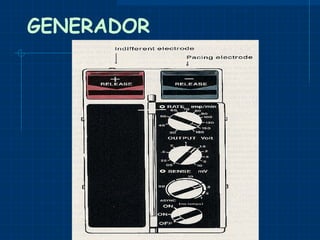 GENERADOR 