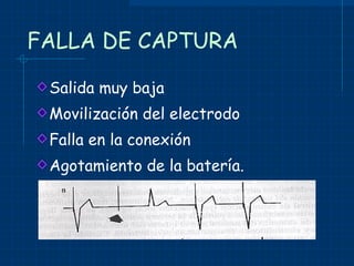 FALLA DE CAPTURA Salida muy baja Movilización del electrodo Falla en la conexión Agotamiento de la batería. 