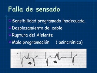 Falla de sensado Sensibilidad programada inadecuada. Desplazamiento del cable Ruptura del Aislante Mala programación  ( asincrónica) 
