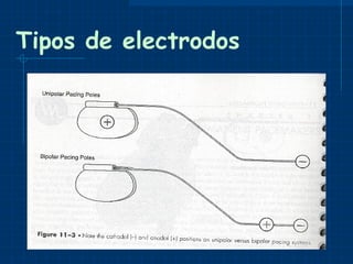 Tipos de electrodos 