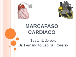 MARCAPASO
CARDIACO
Sustentado por:
Dr. Fernandito Espinal Rosario
 