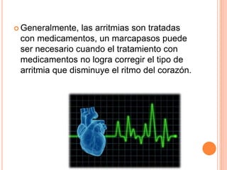  Generalmente, las arritmias son tratadas
con medicamentos, un marcapasos puede
ser necesario cuando el tratamiento con
medicamentos no logra corregir el tipo de
arritmia que disminuye el ritmo del corazón.
 