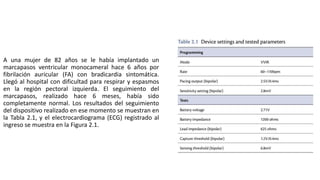 A una mujer de 82 años se le había implantado un
marcapasos ventricular monocameral hace 6 años por
fibrilación auricular (FA) con bradicardia sintomática.
Llegó al hospital con dificultad para respirar y espasmos
en la región pectoral izquierda. El seguimiento del
marcapasos, realizado hace 6 meses, había sido
completamente normal. Los resultados del seguimiento
del dispositivo realizado en ese momento se muestran en
la Tabla 2.1, y el electrocardiograma (ECG) registrado al
ingreso se muestra en la Figura 2.1.
 