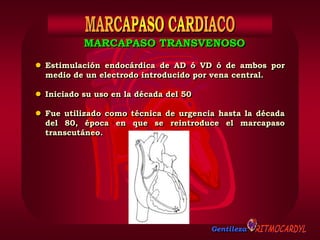 Gentileza
 Estimulación endocárdica de AD ó VD ó de ambos por
medio de un electrodo introducido por vena central.
 Iniciado su uso en la década del 50
 Fue utilizado como técnica de urgencia hasta la década
del 80, época en que se reintroduce el marcapaso
transcutáneo.
MARCAPASO TRANSVENOSO
 