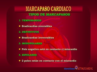 Gentileza
1. TEMPORARIOS
 Bradicardias reversibles
2. DEFINITIVOS
 Bradicardias irreversibles
3. MONOPOLARES
 Polo negativo está en contacto c/miocardio
4. BIPOLARES
 2 polos están en contacto con el miocardio
TIPOS DE MARCAPASOS
 