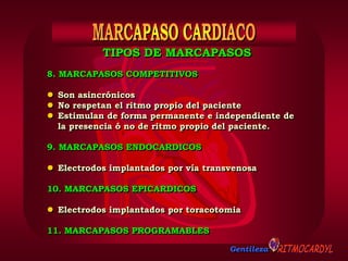 Gentileza
8. MARCAPASOS COMPETITIVOS
 Son asincrónicos
 No respetan el ritmo propio del paciente
 Estimulan de forma permanente e independiente de
la presencia ó no de ritmo propio del paciente.
9. MARCAPASOS ENDOCARDICOS
 Electrodos implantados por vía transvenosa
10. MARCAPASOS EPICARDICOS
 Electrodos implantados por toracotomia
11. MARCAPASOS PROGRAMABLES
TIPOS DE MARCAPASOS
 