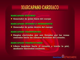 Gentileza
MARCAPASO EXTERNO
 Generador de pulso fuera del cuerpo
 Generador de pulso dentro del cuerpo
MARCAPASO INTERNO O PERMANENTE
 Emplea electrodos que son llevados por las venas
centrales hacia las cámaras derechas del corazón.
MARCAPASO TRANSVENOSO
 Libera impulsos hacia el corazón a través la piel,
mediante electrodos cutáneos.
MARCAPASO TRANSCUTANEO
 