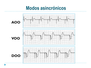 Modos asincrónicos

AOO



VOO



DOO
 