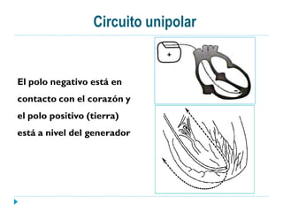 Circuito unipolar


El polo negativo está en
contacto con el corazón y
el polo positivo (tierra)
está a nivel del generador
 