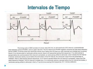 Intervalos de Tiempo
 
