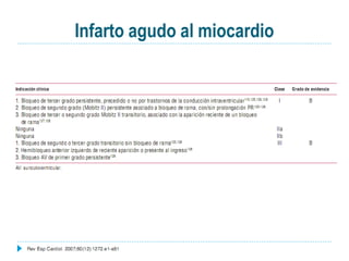Infarto agudo al miocardio
 
