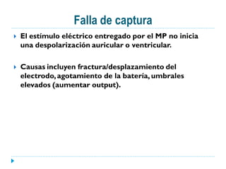 Falla de captura
   El estímulo eléctrico entregado por el MP no inicia
    una despolarización auricular o ventricular.

   Causas incluyen fractura/desplazamiento del
    electrodo, agotamiento de la batería, umbrales
    elevados (aumentar output).
 