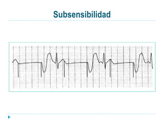 Subsensibilidad
 