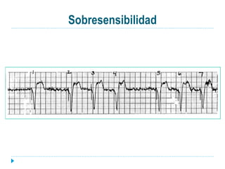 Sobresensibilidad
 