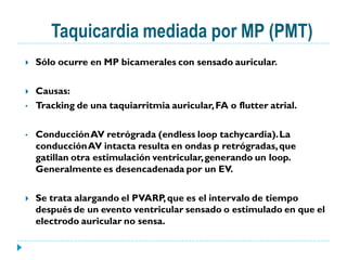 Taquicardia mediada por MP (PMT)
   Sólo ocurre en MP bicamerales con sensado auricular.

   Causas:
•   Tracking de una taquiarritmia auricular, FA o flutter atrial.

•   Conducción AV retrógrada (endless loop tachycardia). La
    conducción AV intacta resulta en ondas p retrógradas, que
    gatillan otra estimulación ventricular, generando un loop.
    Generalmente es desencadenada por un EV.

   Se trata alargando el PVARP, que es el intervalo de tiempo
    después de un evento ventricular sensado o estimulado en que el
    electrodo auricular no sensa.
 